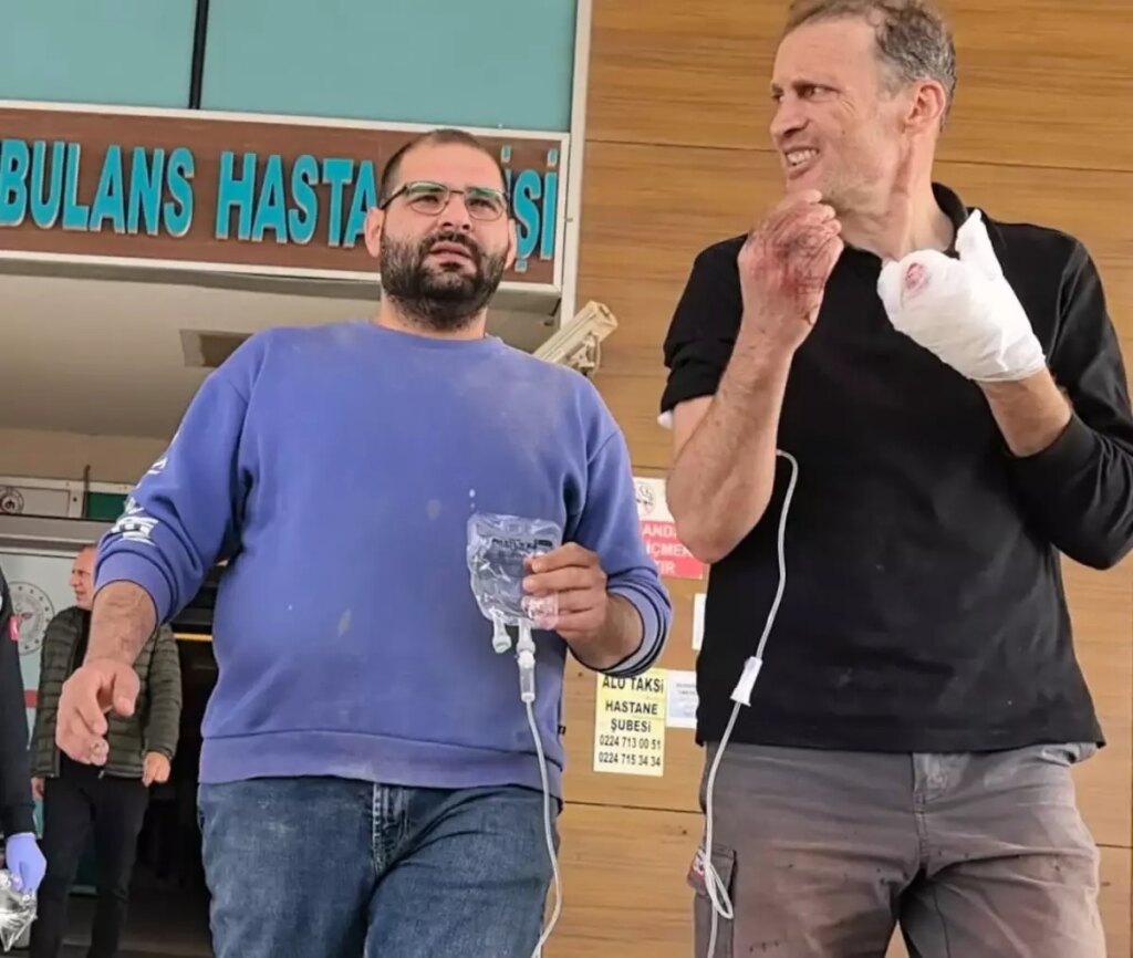 freze makinesine kaptirdigi elinden iki parmak koptu 4rviaTVm.jpg