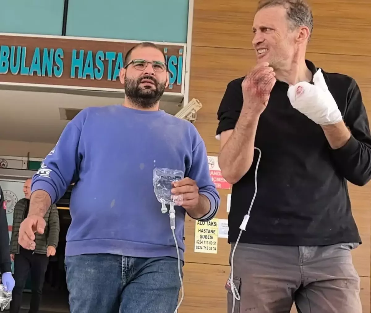 freze makinesine kaptirdigi elinden iki parmak koptu 4rviaTVm.jpg